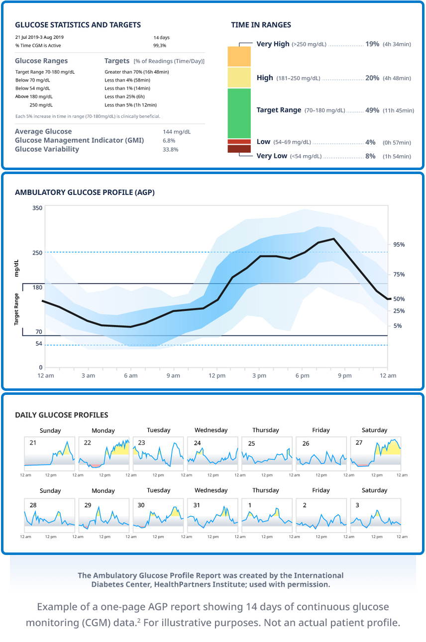 15分鐘CGM報告解讀
